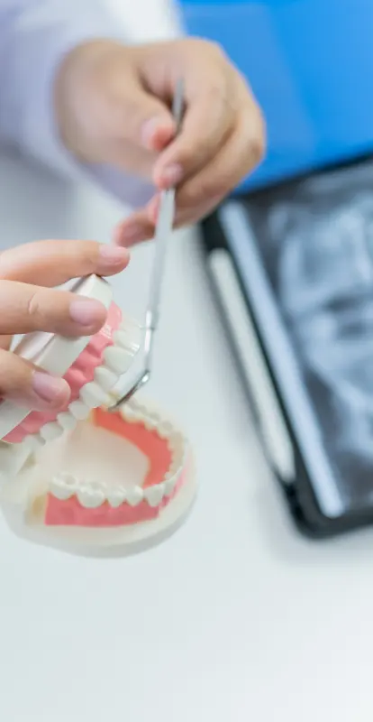 Injerto óseo para implantes: cuándo se indica, técnicas y recuperación