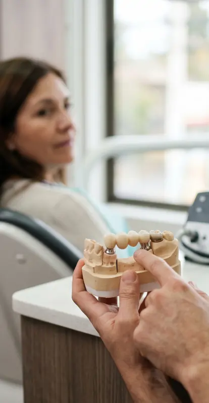 Puente dental vs. implante dental: diferencias, duración y cuándo conviene cada opción