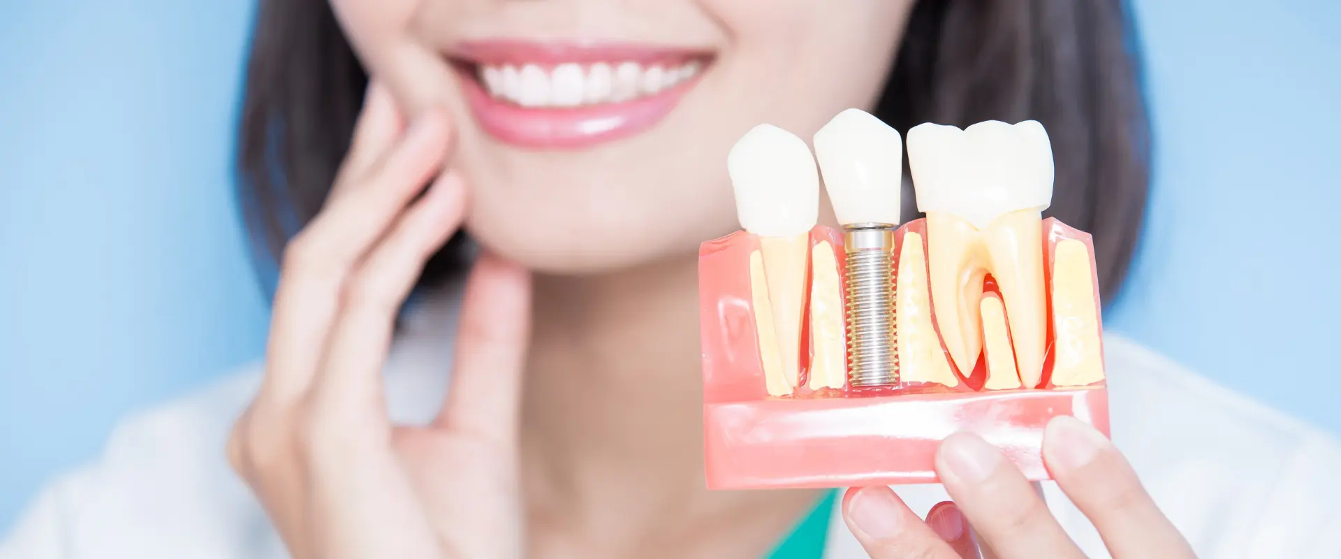 Cuidados post implante dental: Guía completa para una recuperación sin complicaciones