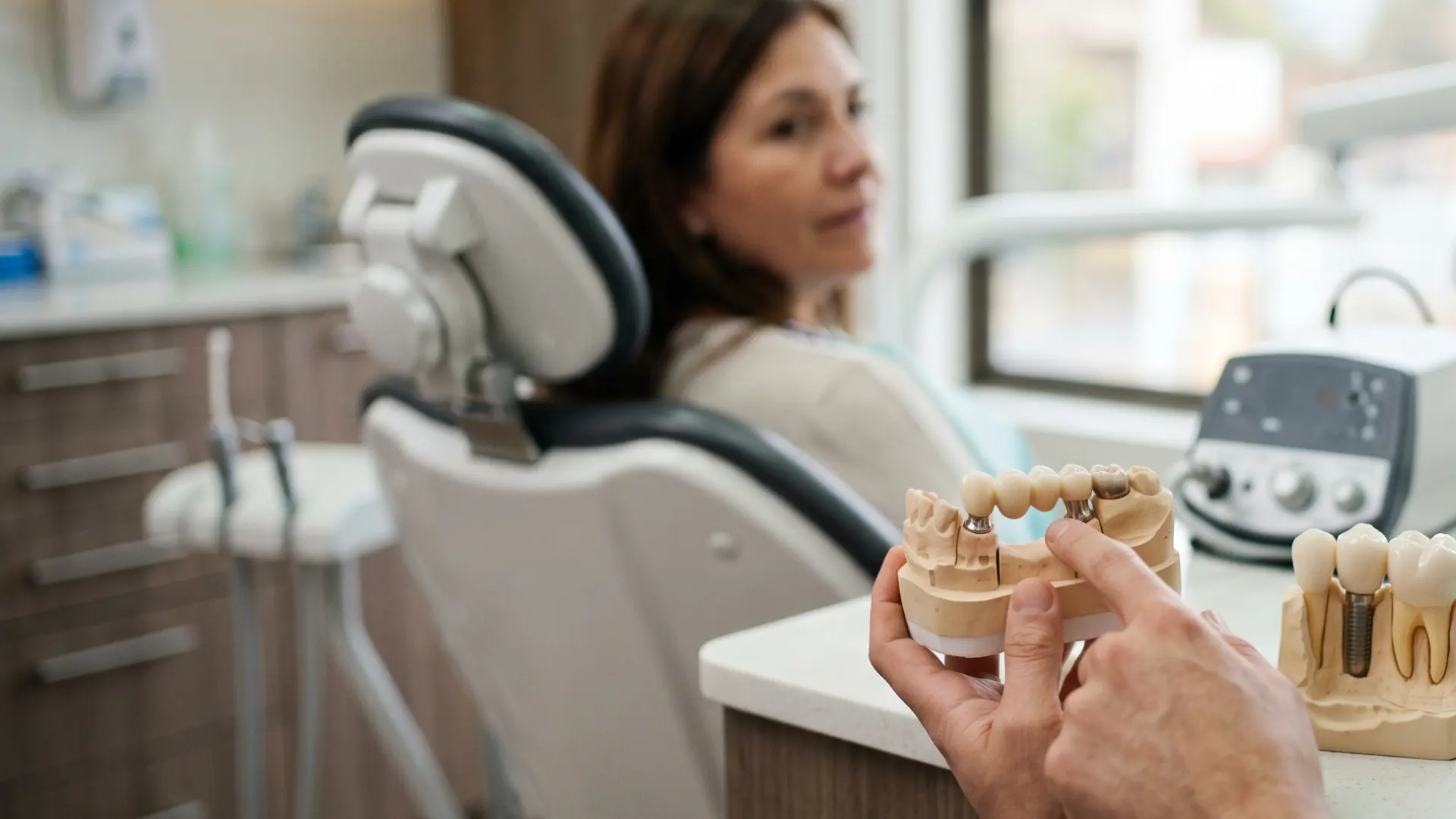 Puente dental vs. implante dental: diferencias, duración y cuándo conviene cada opción